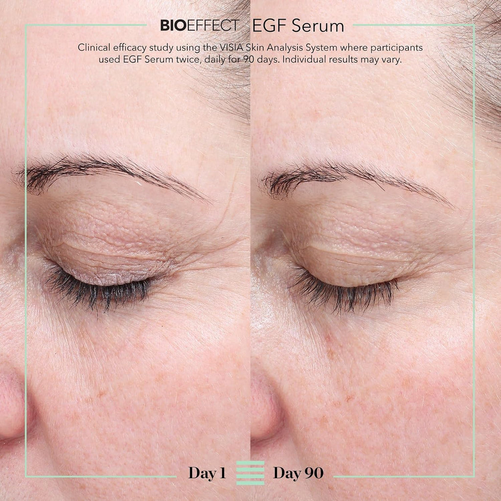 BIOEFFECT EGF Serum with Growth Factor | Firming, Age Defying Face Serum