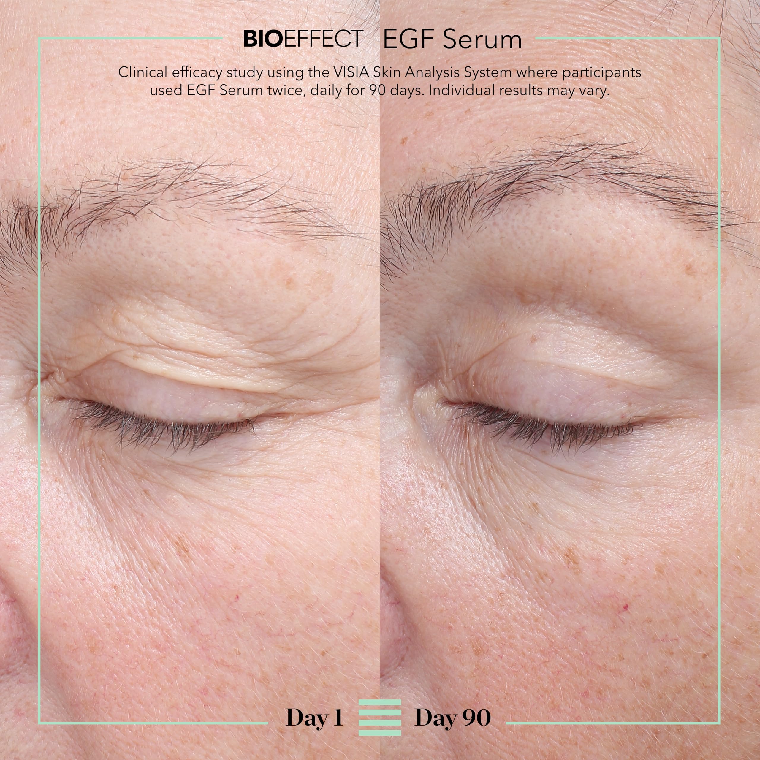 BIOEFFECT EGF Serum with Growth Factor | Firming, Age Defying Face Serum